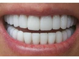 teeth whitening